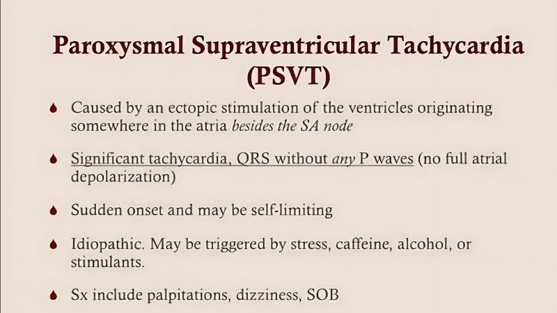 Paroxysmal Supraventricular Tachycardia causes range from heart issues to stress