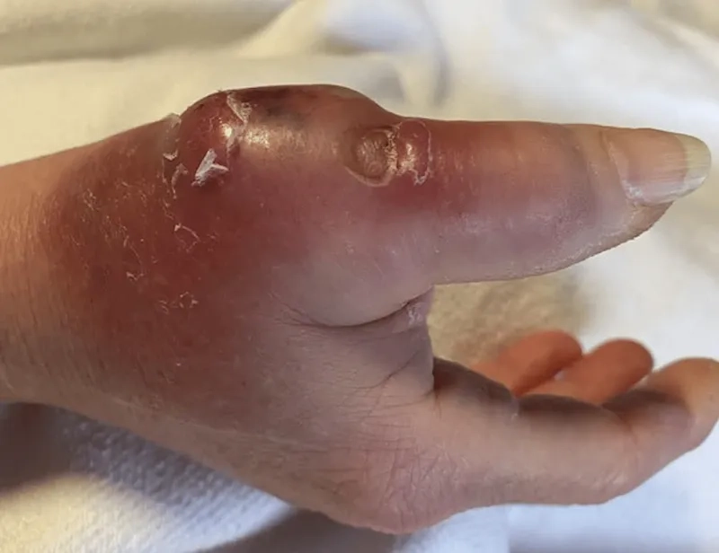 Doctor discussing options for pasteurellosis treatment