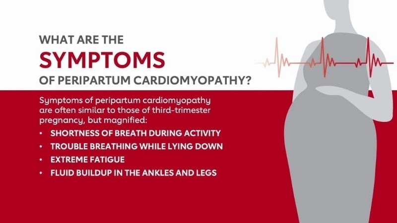 Peripartum cardiomyopathy symptoms affecting mother heart