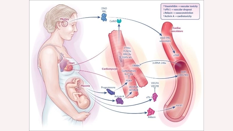 Peripartum cardiomyopathy risk factors warning signs