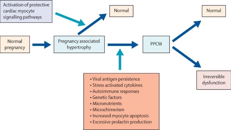 Can you recover from peripartum cardiomyopathy hope for moms