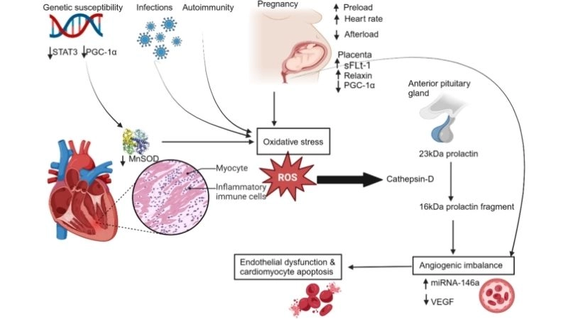 Peripartum cardiomyopathy and pregnancy needs careful care