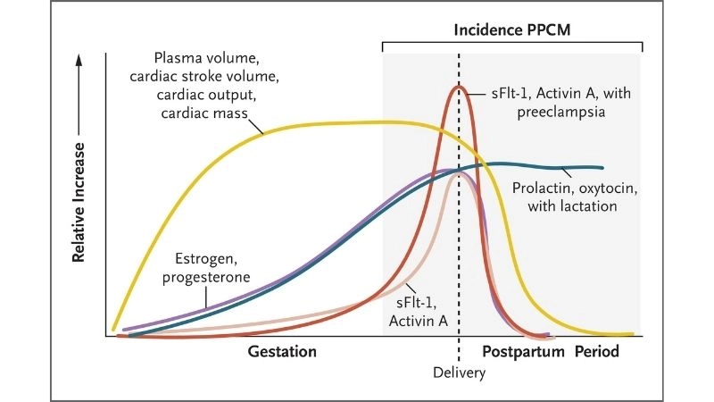 Peripartum cardiomyopathy vs takotsubo know the difference