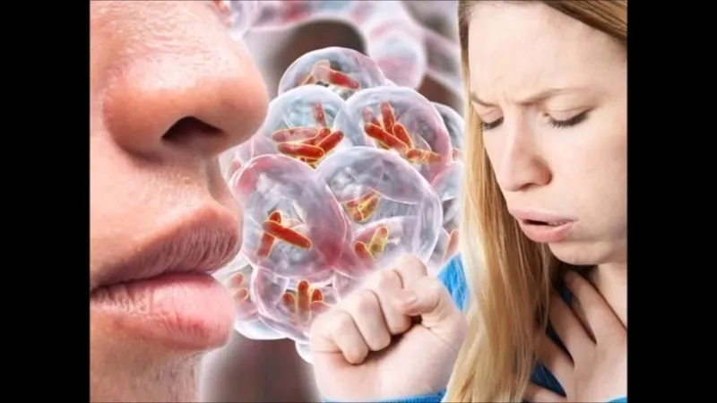 A severe case of pertussis in adults