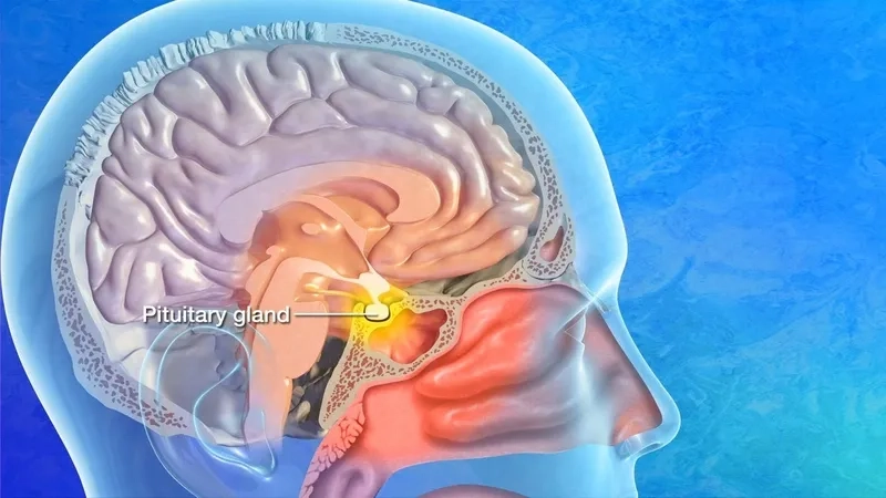 Anatomical illustration showing what is a pituitary tumor