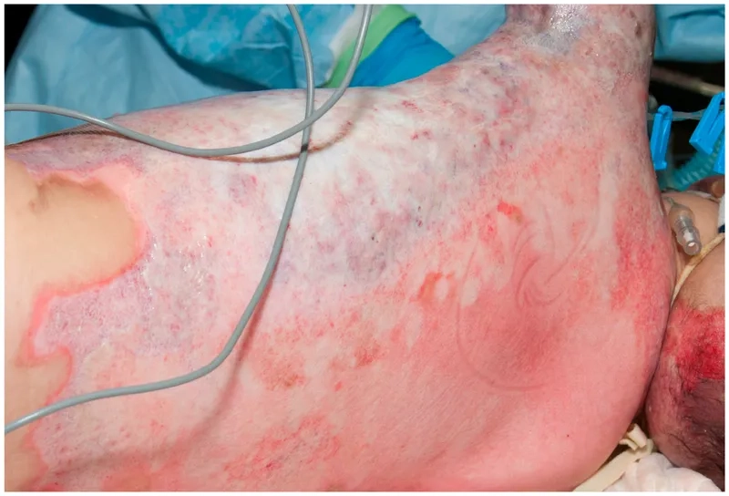 A micrograph of the bacterium Yersinia pestis