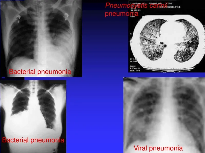 Elderly person showing subtle signs of pneumonia
