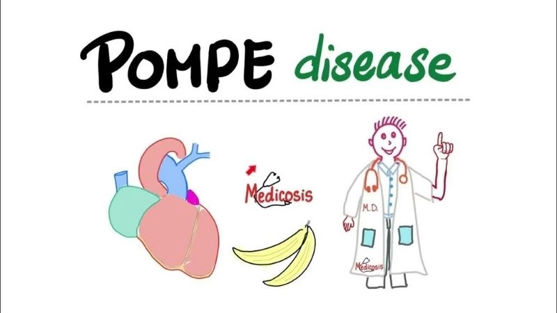 Uncover the truth of pompe disease symptoms