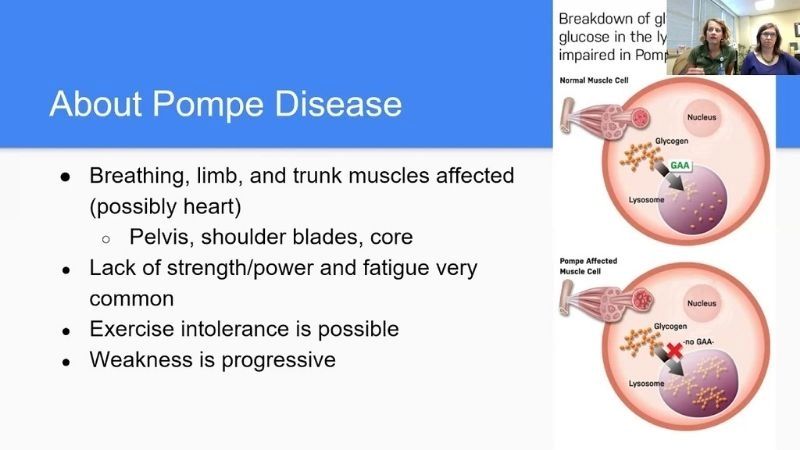 Mystery of infantile onset pompe disease revealed