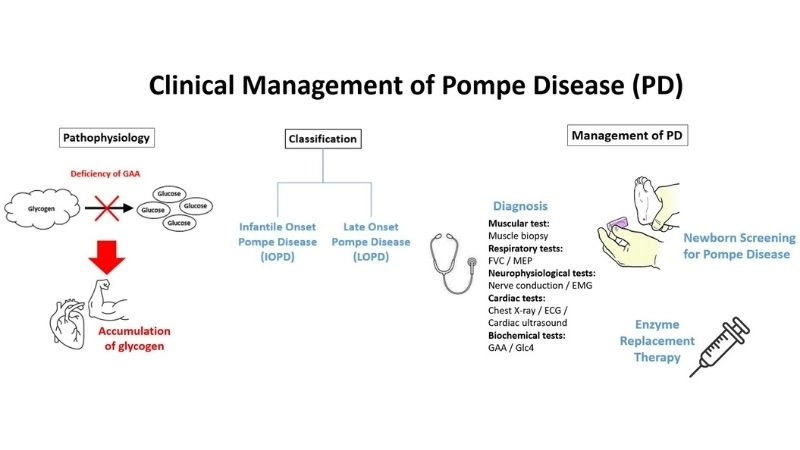Journey of late onset pompe disease continues