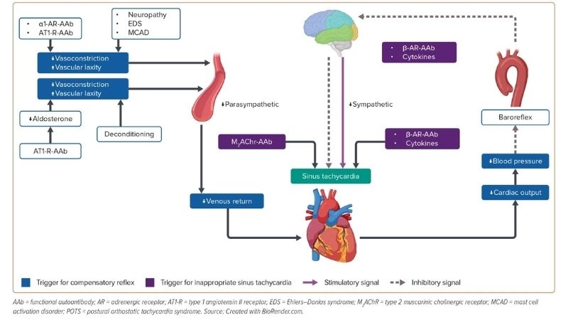 POTS And Brain Fog impact memory and focus