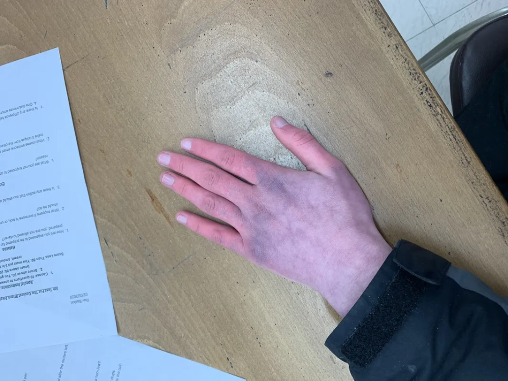 Pots diet and supportive nutrition guidelines