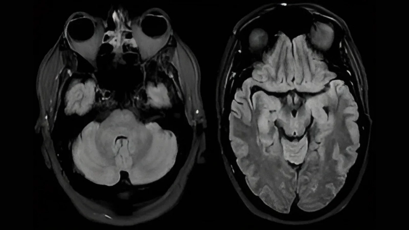 Discover Powassan virus life cycle to stay informed
