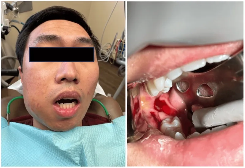 An illustration of bacteria in the human gut microbiome