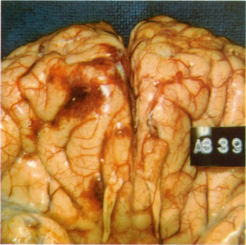 An overview of the experimental PAM treatment protocol