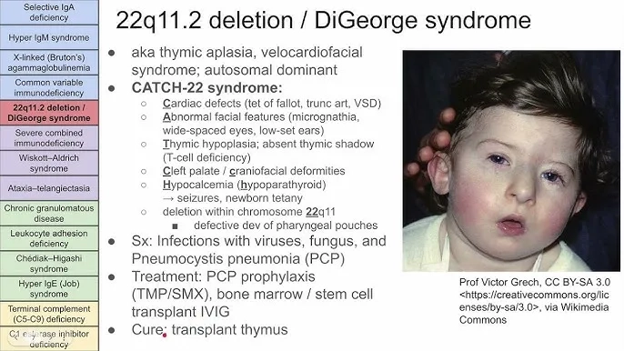 Clinical signs of primary immunodeficiency symptoms
