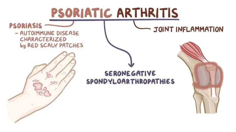 The common psoriatic arthritis symptoms