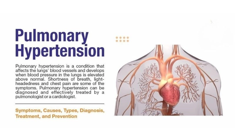 Pulmonary embolism causes and underlying triggers