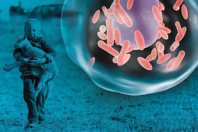 Administering the vaccine for Q fever