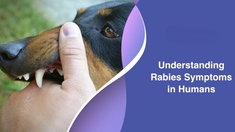 Rabies diagnosis requires lab testing quickly