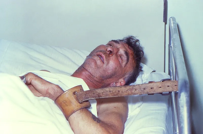 Rabies treatment is urgent after exposure