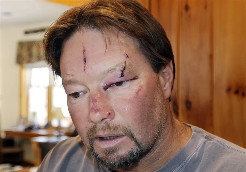 Administering the Life-Saving Rabies Vaccine