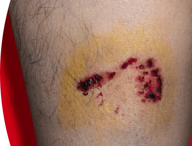 Rabies in cats is dangerous for humans