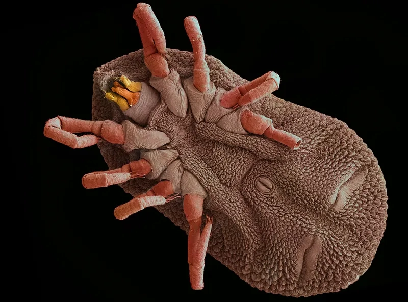 Microscopic view of the spiral-shaped Borrelia bacteria