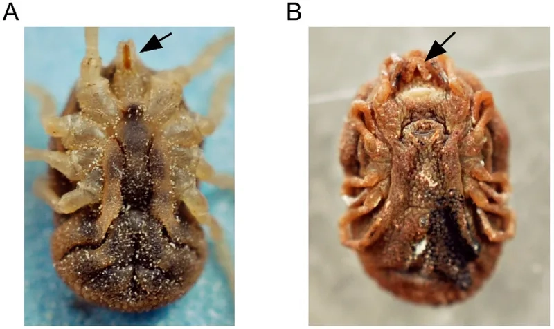 A medical chart explaining what is relapsing fever