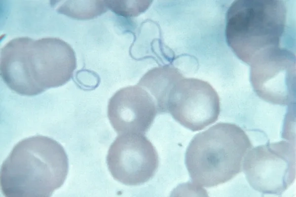 IV antibiotics are a common relapsing fever treatment