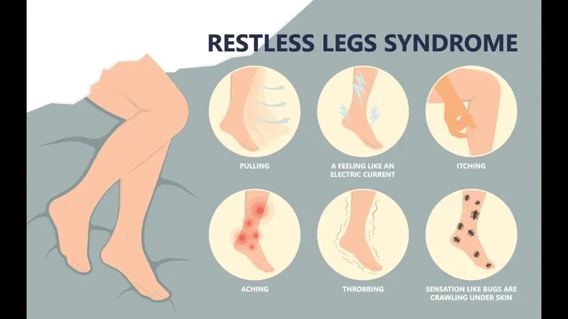A person stretching to show how to stop restless legs