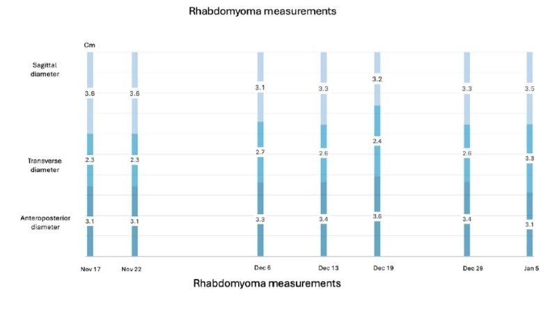 Clinical approach to rhabdomyoma treatment options