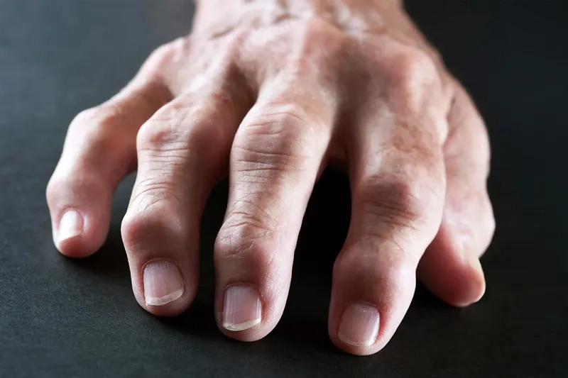 Healthy foods included in an anti-inflammatory RA diet