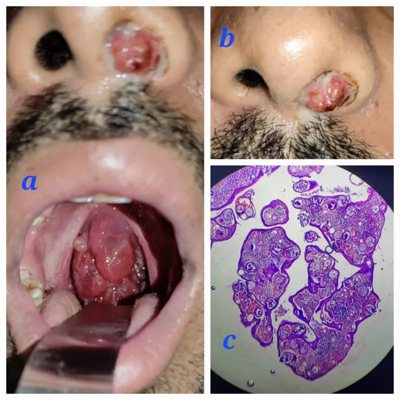 The life cycle of the aquatic protistan parasite