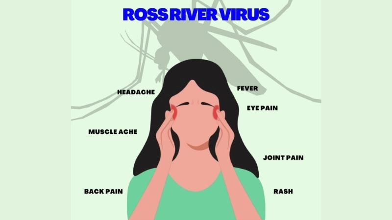 Ross River Fever and best Ross River fever treatment