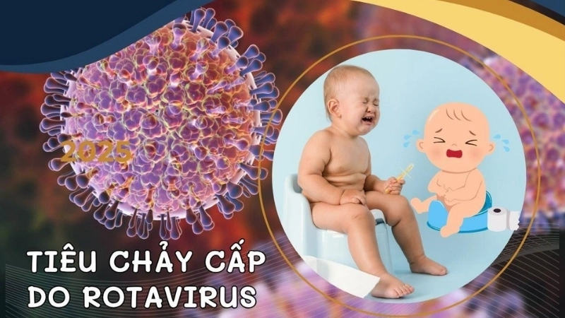 Rotavirus Infection spreads by rotavirus transmission