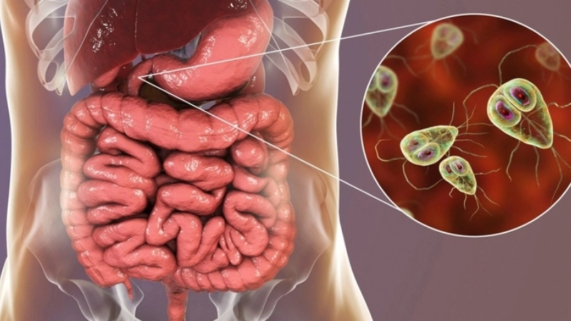 Rotavirus Infection confirmed with rotavirus diagnosis