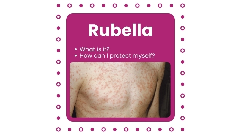 Rubella vaccine prevents Rubella
