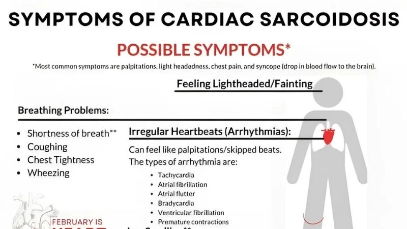 Sarcoidosis and arrhythmia irregular heartbeats from inflammation