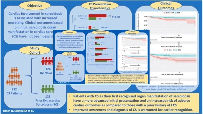 Cardiac sarcoidosis echo findings ultrasound insights for diagnosis