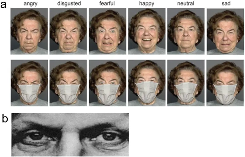 A chart showing schizoaffective disorder symptoms