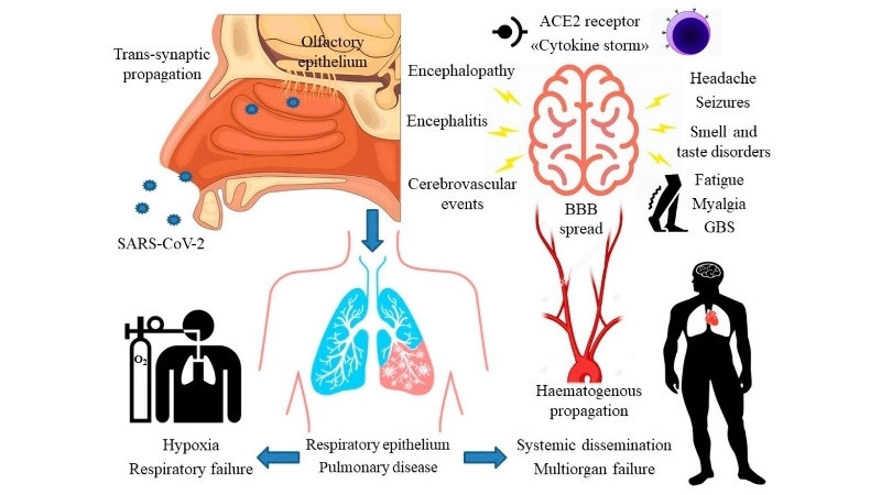 Explore effective SARS treatment options today