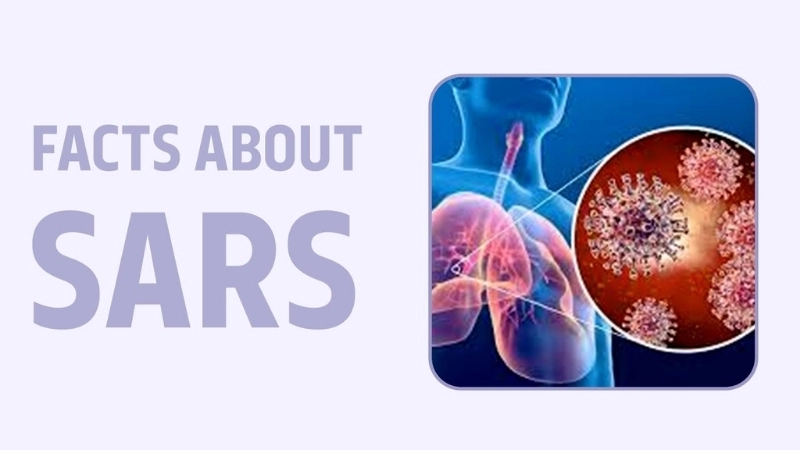 Key symptoms of severe acute respiratory syndrome (SARS) to watch for