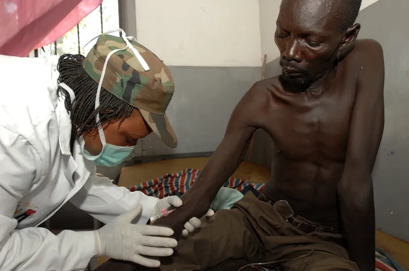 A patient showing sickle cell anemia symptoms