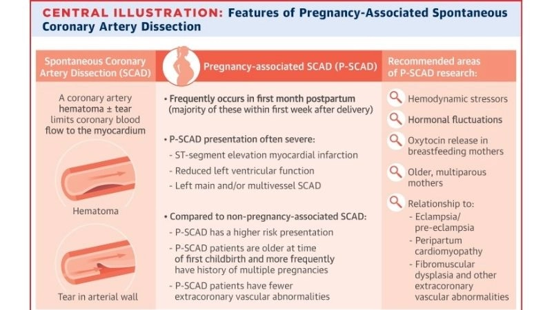 Risks of SCAD and pregnancy complications