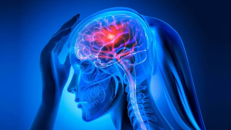 Understanding the FAST acronym for stroke