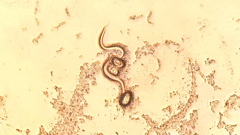 An overview of available strongyloidiasis treatment