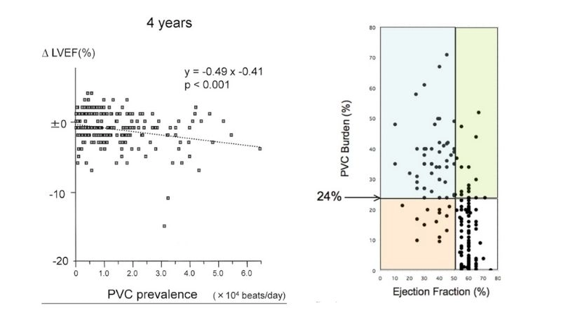 Atrial fibrillation and cardiomyopathy link between irregular rhythm and heart