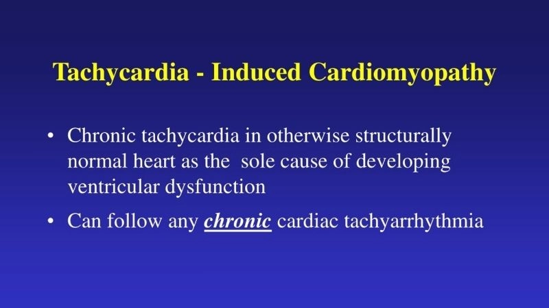 Tachycardia induced cardiomyopathy diagnosis early detection is crucial