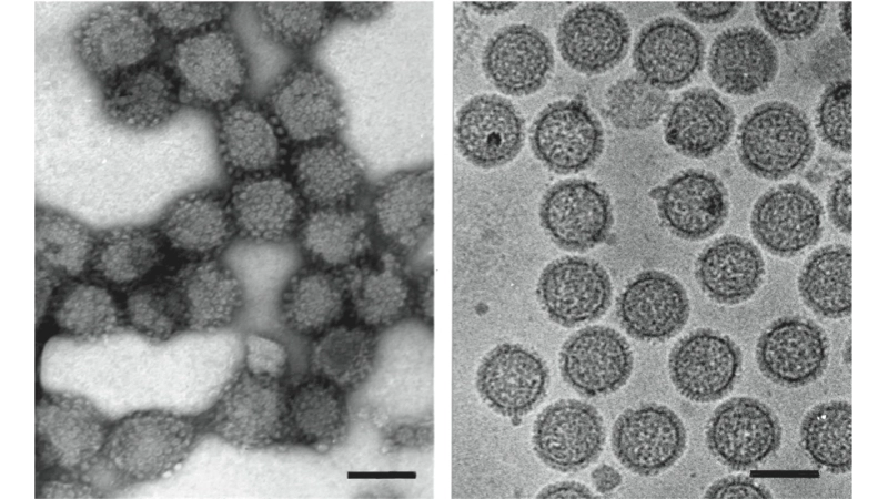 Tahyna Virus Infection linked to Tahyna virus outbreak